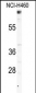 RPL23A Antibody (Center)